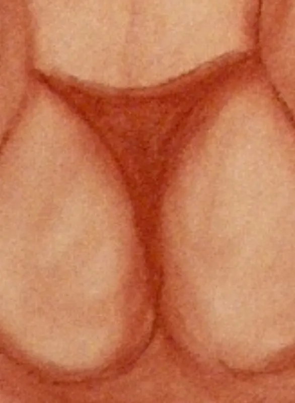 Sanguine II